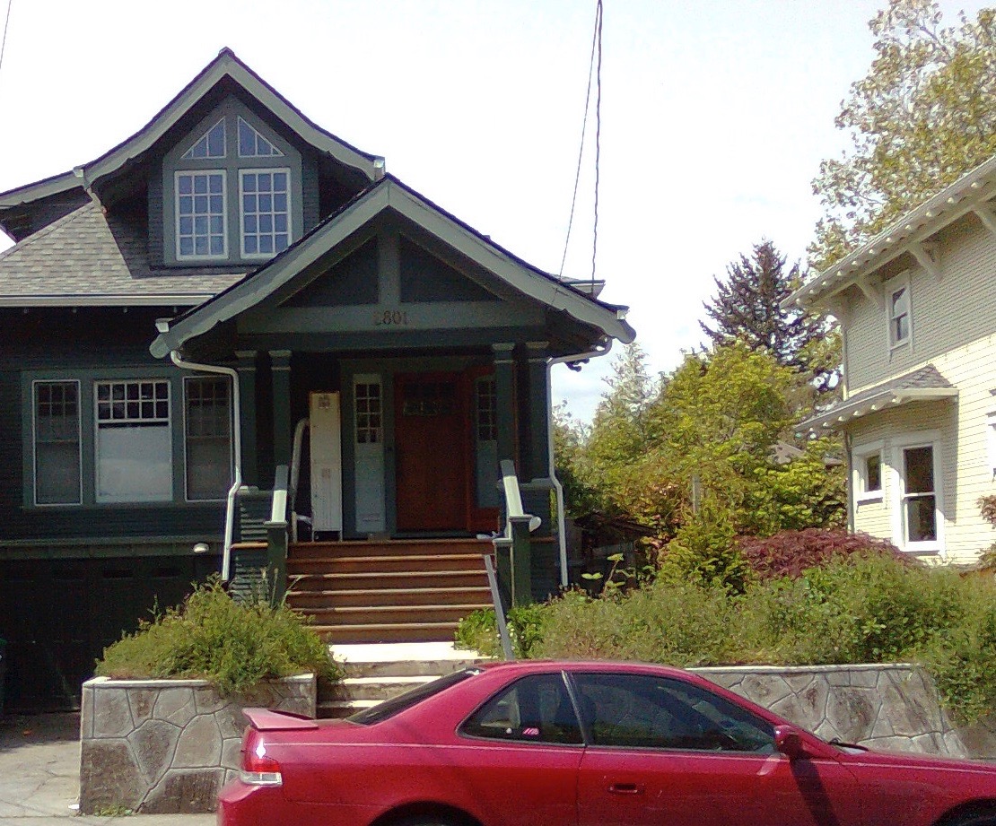 Before & After Gallery 25